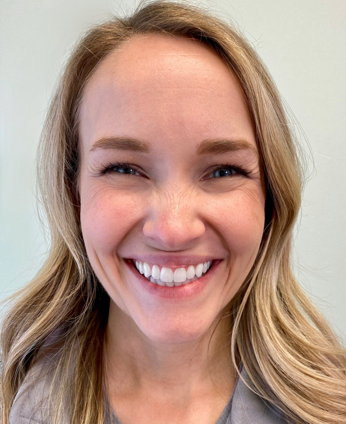 Smiling woman showcasing Invisalign results from Bull Mountain Orthodontics, a Tigard orthodontist.