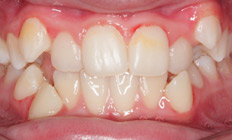 orthodontist tigard or