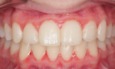 orthodontist tigard or