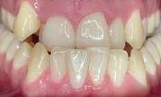 orthodontist tigard or