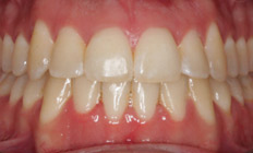 orthodontist tigard or