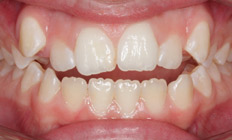 orthodontist tigard or