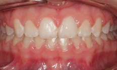orthodontist tigard or