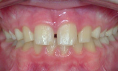 orthodontist tigard or