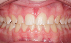 orthodontist tigard or