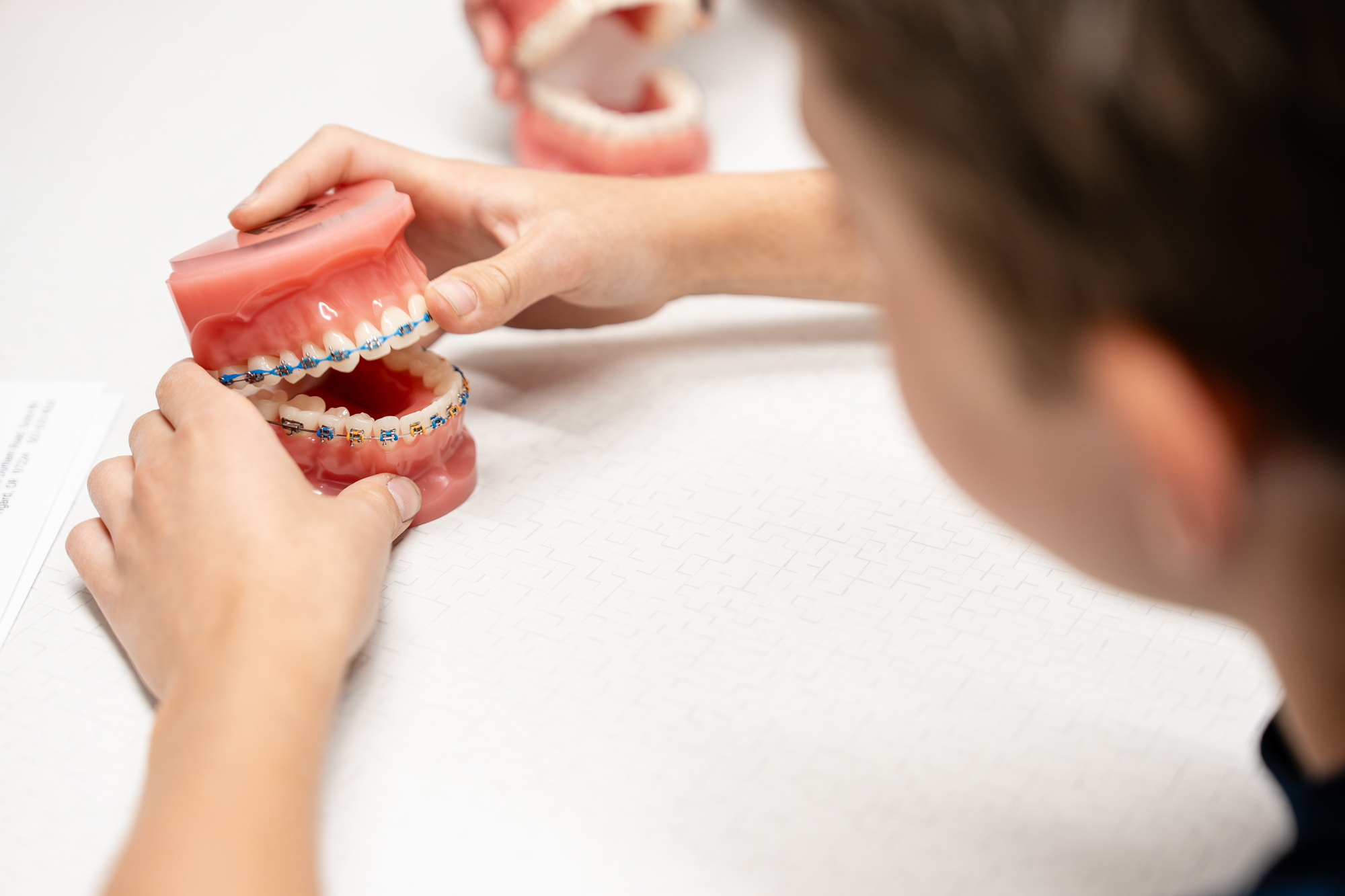 Metal Braces